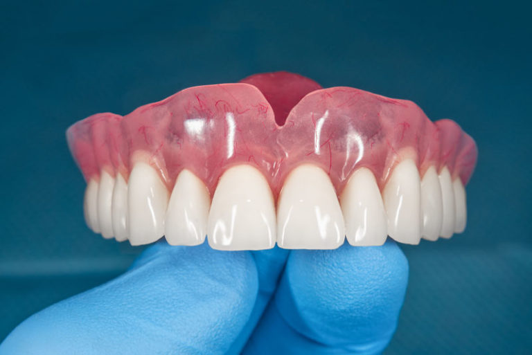 Full & Partial Dentures Lexington, KY Bluegrass Dentistry