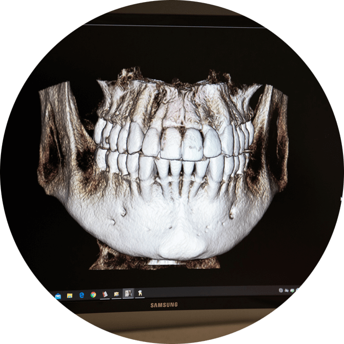 jaw bone scan