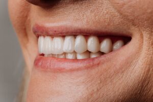 Patient consulting with a dentist about dental implants in a modern office.